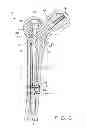 Fig. 08 - Intramedullary nail