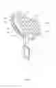 Fig. 02 - Orthopedic bonding agent application tool