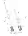 Fig. 09 - Apparatus for reinforcing bone and tools for mounting the same