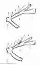Fig. 04 - MEDICAL PROCEDURE ACCESS KIT