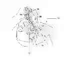 Fig. 01 - Intubating forceps and associated method