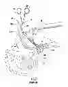 Fig. 04 - Intubating forceps and associated method