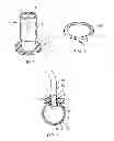 Fig. 02 - Medical device: laparoscopic bag