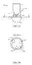Fig. 09 - SYSTEMS AND METHODS FOR NAVIGATION AND CONTROL OF AN IMPLANT POSITIONING DEVICE
