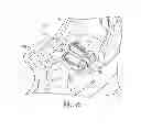 Fig. 35 - ULTRASONIC AND ELECTROSURGICAL DEVICES