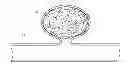 Fig. 01 - OCCLUSIVE DEVICES