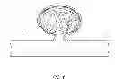 Fig. 02 - OCCLUSIVE DEVICES