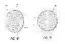 Fig. 06 - OCCLUSIVE DEVICES