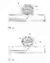 Fig. 22 - OCCLUSIVE DEVICES