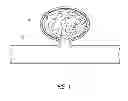 Fig. 02 - OCCLUSIVE DEVICES