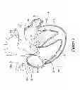 Fig. 02 - LEFT ATRIAL APPENDAGE CLOSURE IMPLANT