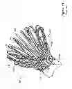 Fig. 07 - LEFT ATRIAL APPENDAGE CLOSURE IMPLANT