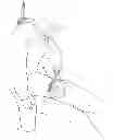 Fig. 01 - TOURNIQUET AND METHOD OF USE