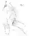 Fig. 02 - TOURNIQUET AND METHOD OF USE