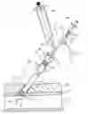Fig. 01 - Sheath and balloon tensioner and locator systems and methods