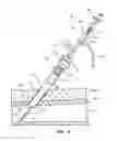 Fig. 05 - Sheath and balloon tensioner and locator systems and methods