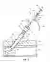 Fig. 06 - Sheath and balloon tensioner and locator systems and methods