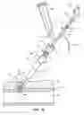 Fig. 09 - Sheath and balloon tensioner and locator systems and methods