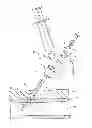 Fig. 01 - Delivery tip for extravascular bioadhesive catheter and methods