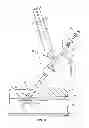 Fig. 09 - Delivery tip for extravascular bioadhesive catheter and methods