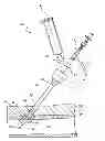 Fig. 01 - Blocking sleeve for bioadhesive delivery device and methods