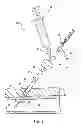 Fig. 07 - Blocking sleeve for bioadhesive delivery device and methods