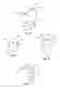 Fig. 09 - Procedural sheath adapter for vascular closure device