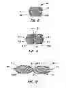 Fig. 06 - Multi-layer braided structures for occluding vascular defects