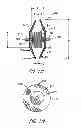 Fig. 07 - Multi-layer braided structures for occluding vascular defects