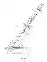 Fig. 04 - DUAL DELIVERY SYSTEMS, DEVICES, AND RELATED METHODS FOR BIOADHESIVES