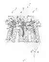 Fig. 04 - MODULAR PERCUTANEOUS SPINAL FUSION