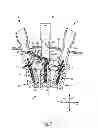 Fig. 08 - MODULAR PERCUTANEOUS SPINAL FUSION