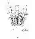 Fig. 09 - MODULAR PERCUTANEOUS SPINAL FUSION