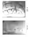 Fig. 08 - METHODS AND APPARATUS FOR IMPROVING SHEAR LOADING CAPACITY OF A SPINAL SEGMENT