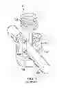 Fig. 02 - Percutaneous modular head-to-head cross connector