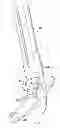 Fig. 03 - Percutaneous modular head-to-head cross connector