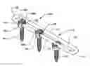 Fig. 01 - Spinal stabilization system
