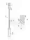 Fig. 04 - Spinal stabilization system
