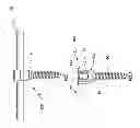 Fig. 02 - Spinal stabilization system