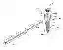 Fig. 01 - Spinal stabilization system