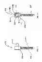 Fig. 10 - Spinal stabilization system