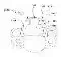 Fig. 01 - Laminoplasty devices and methods