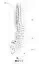 Fig. 02 - Laminoplasty devices and methods