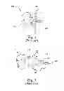 Fig. 03 - Laminoplasty devices and methods