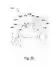 Fig. 18 - Laminoplasty devices and methods