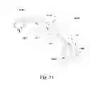 Fig. 19 - Laminoplasty devices and methods