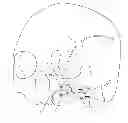 Fig. 01 - Methods for repairing craniomaxillofacial bones using customized bone plate