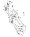 Fig. 06 - Anterior cervical plate