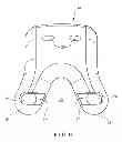 Fig. 06 - LOCKING PIN PLATE ASSEMBLY ADAPTED FOR FRACTURE FIXATION