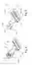 Fig. 04 - Multi-directional thorax wall stabilisation